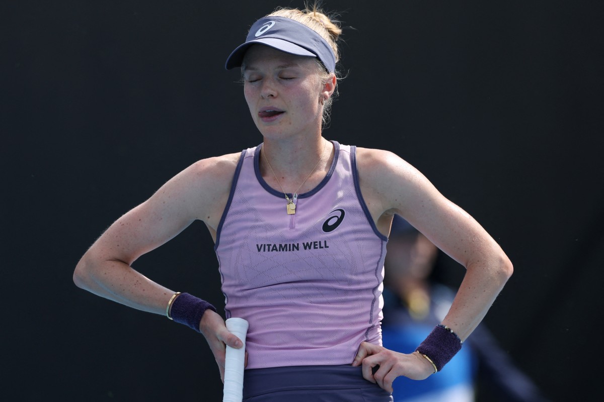 英國網球選手達特(Harriet Dart)抱怨對手體味太重的畫面意外曝光。法新社