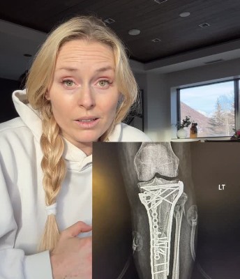 沃恩在冬奧重傷後終於出院。摘自沃恩IG