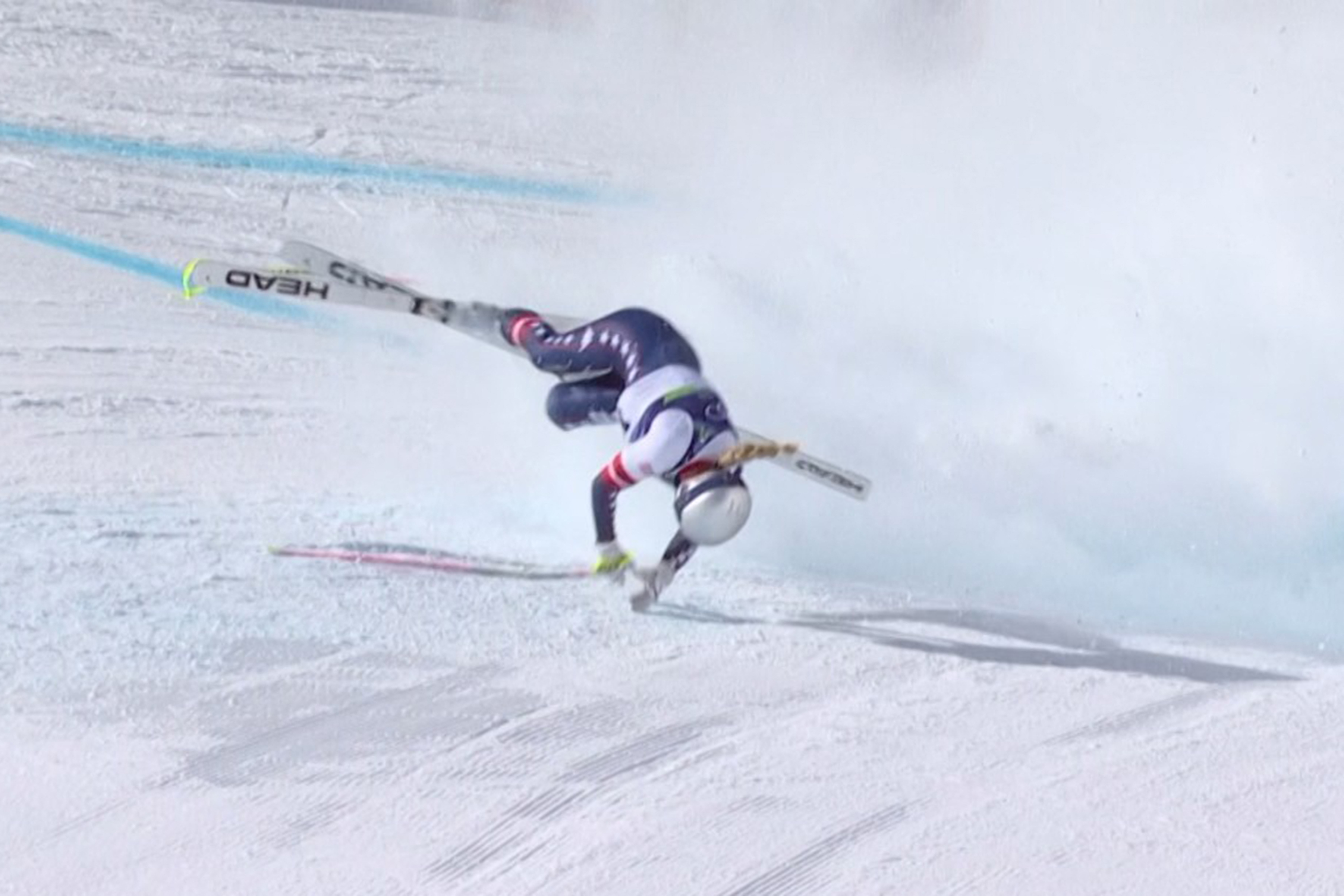 美國滑雪女神沃恩（Lindsey Vonn）於米蘭科爾蒂納冬季奧運女子高山滑雪(downhill)賽事中發生嚴重意外。法新社
