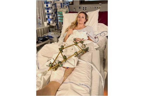 美國滑雪女神沃恩（Lindsey Vonn）展示可怕的傷情。摘自沃恩IG