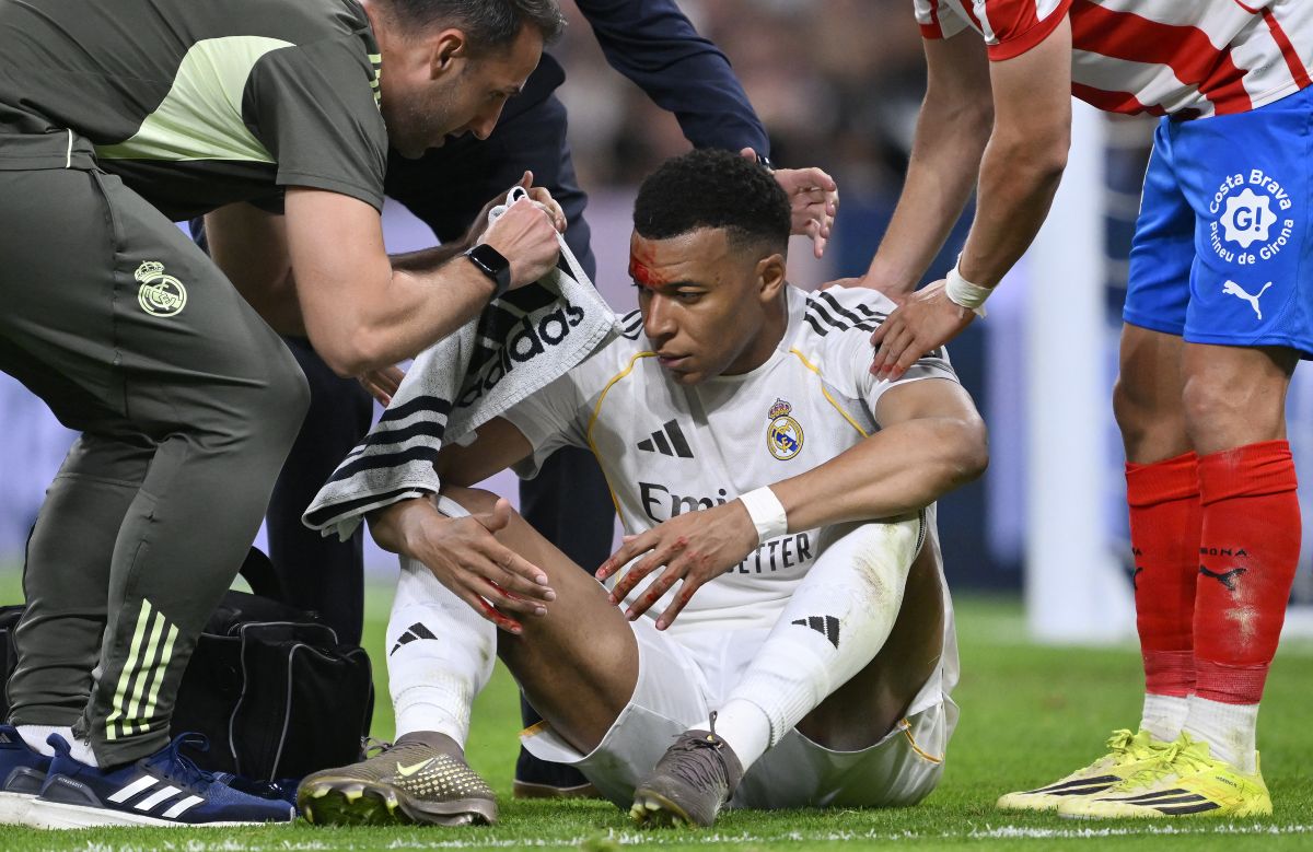 姆巴佩血濺賽場卻竟未獲12碼球。法新社