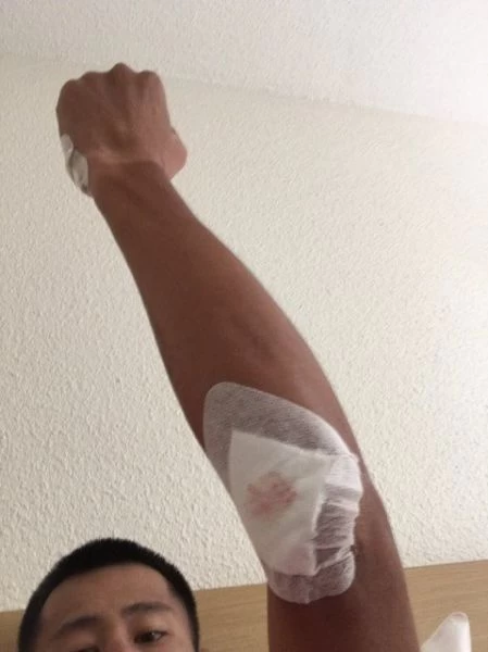 阿凱身上有多處擦傷,但第三站仍將出賽。巴林美利達車隊提供