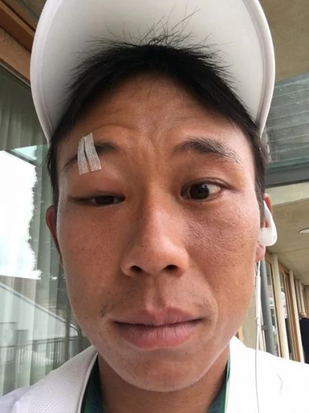 陳迪右腿貼膠帶出賽。摘自陳迪臉書