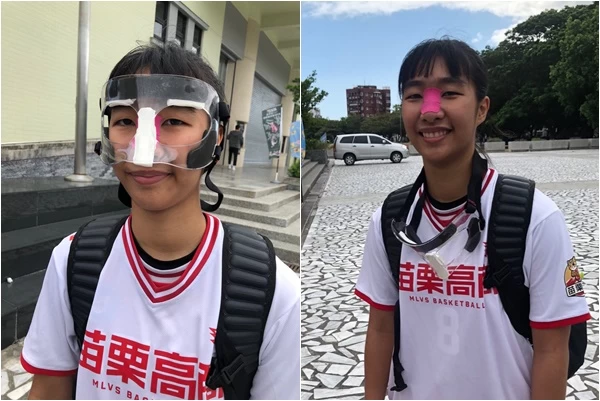 「新膠面人」杜思婷鼻傷前後。合成照片