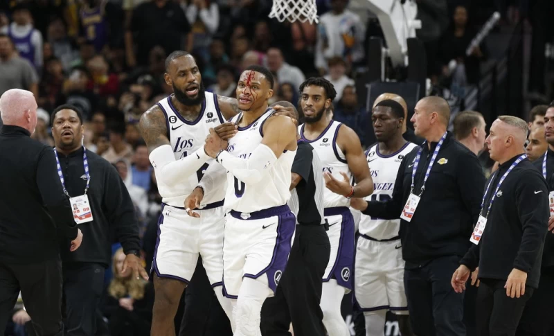魏斯布魯克(Russell Westbrook)遭爆頭濺血。法新社
