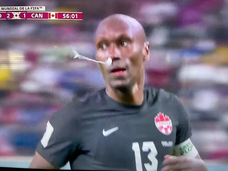 加拿大哈欽森(Atiba Hutchinson)在比賽中用衛生棉條止血。摘自推特