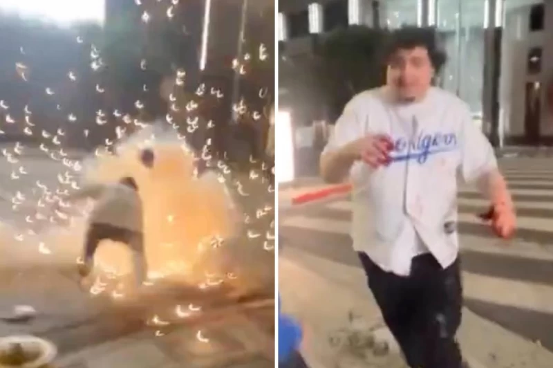 道奇球迷點煙火左手被炸。摘自每日郵報推特