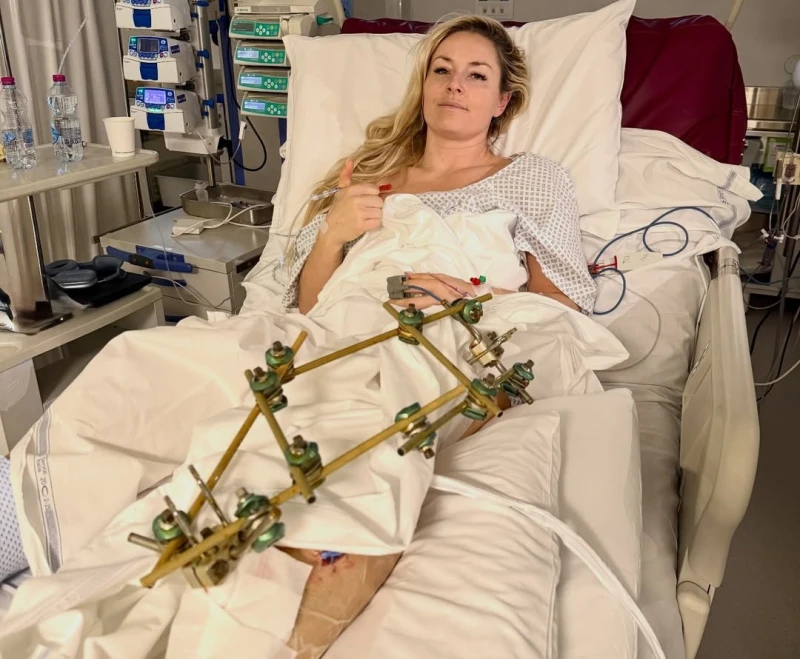 美國滑雪女神沃恩（Lindsey Vonn）表示，在接受計劃中的第四次腿部骨折手術後，希望能返回美國。摘自沃恩ＩＧ