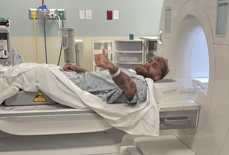 網紅拳擊手傑克保羅（Jake Paul）行了第二次下顎手術。摘自保羅IG