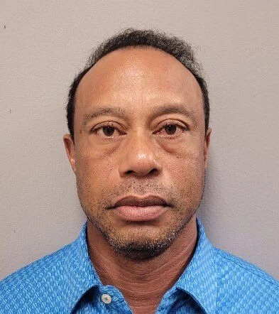 美國高爾夫球巨星老虎伍茲(Tiger Woods)認錯將暫別球壇接受治療。法新社